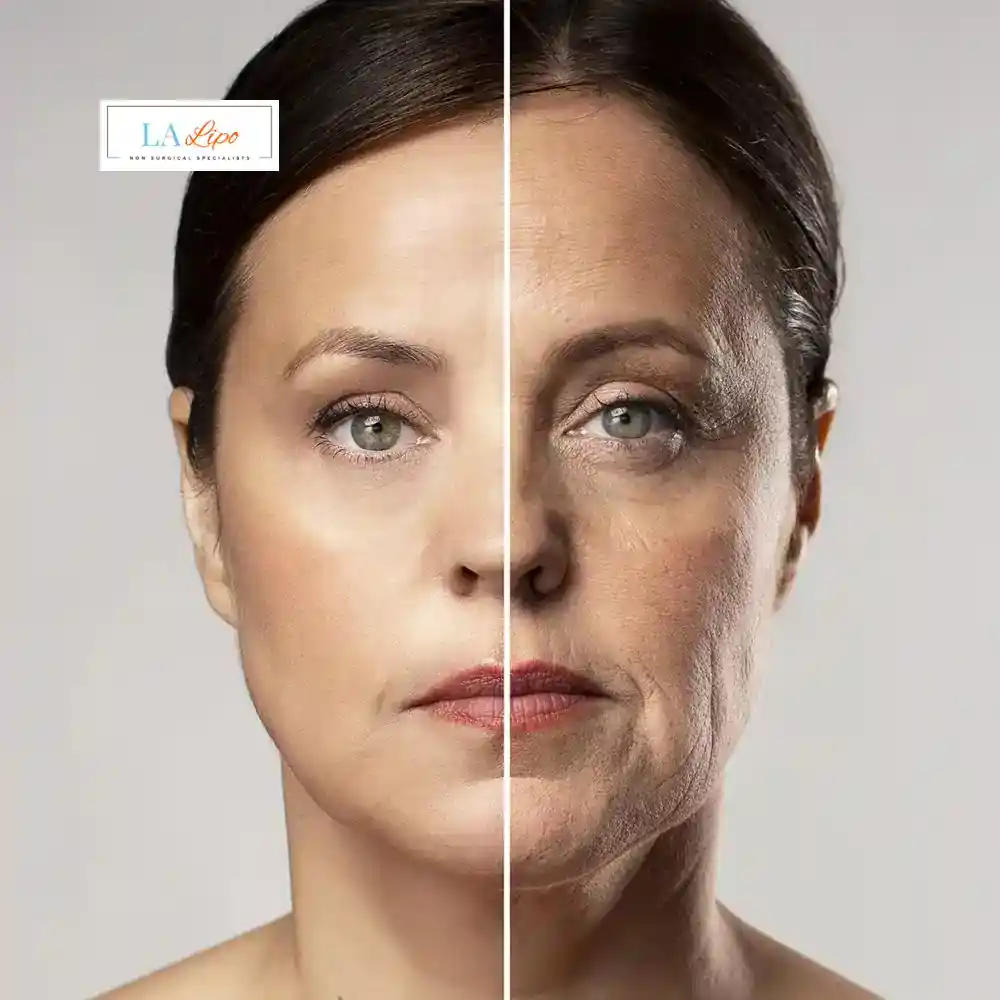 How Can You Tell If Non-Surgical Skin Tightening Is Right for You Neasden?