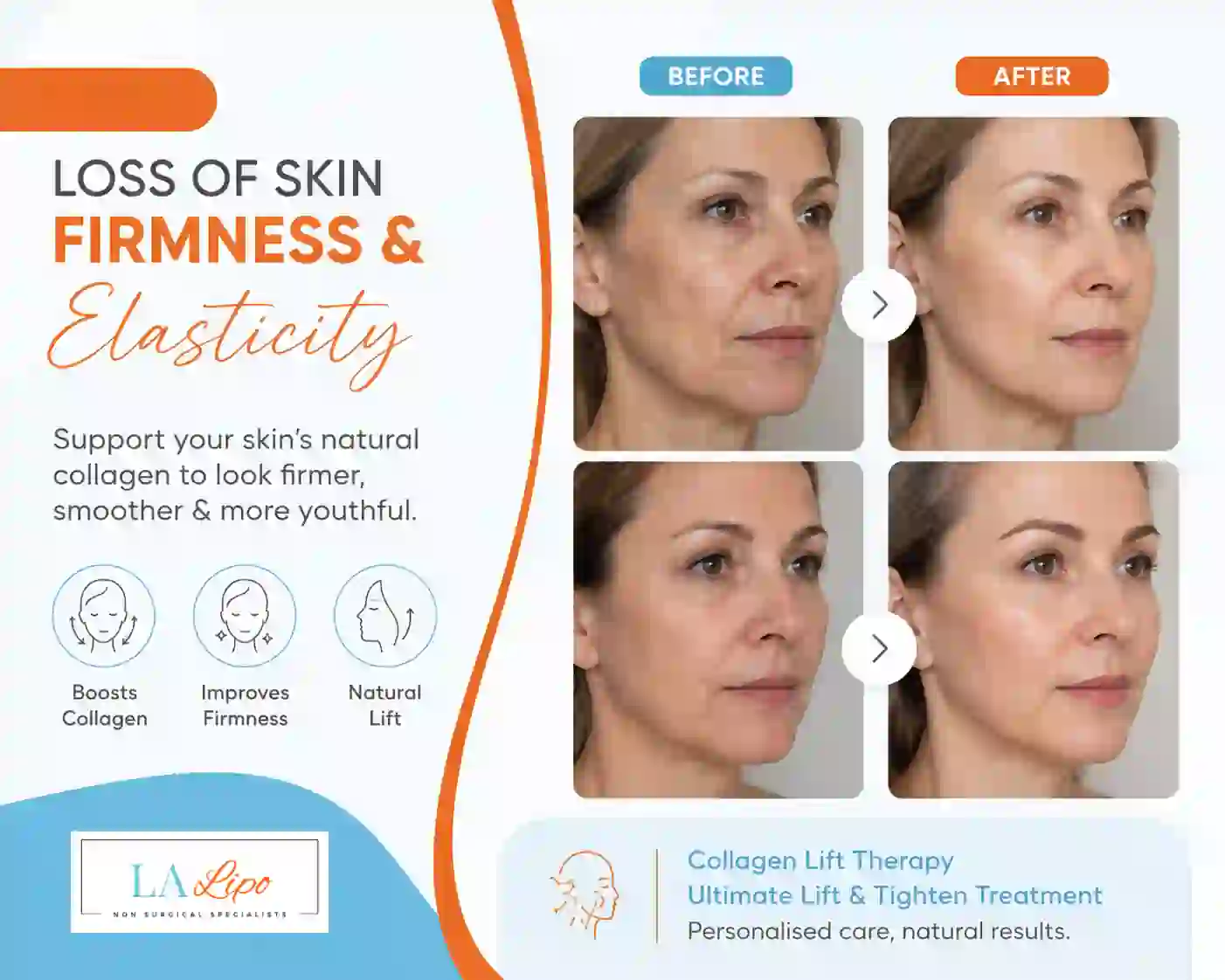 Sign #7: Loss of Skin Firmness and Elasticity Neasden
