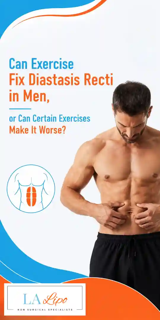 Can Exercise Fix Diastasis Recti in Men, or Can Certain Exercises Make It Worse Neasden?